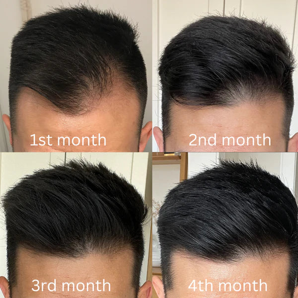 Fifteen15 –  Natural Hair Oil