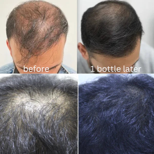 Fifteen15 –  Natural Hair Oil